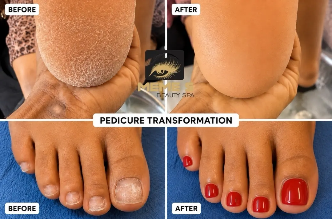 Pedicure